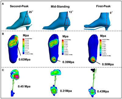 Best heel to toe drop for hot sale plantar fasciitis